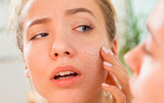 7 consejos para mejorar tu piel en invierno